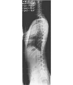 After Image