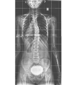 After Image