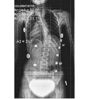After Image