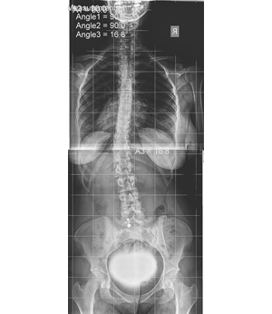 After Image
