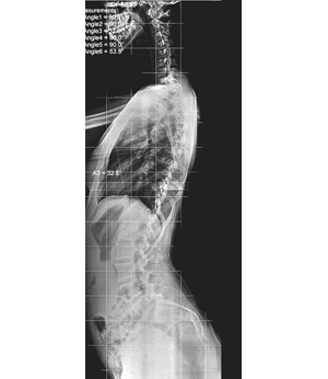 After Image