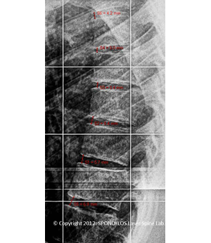 After Image