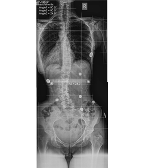 After Image