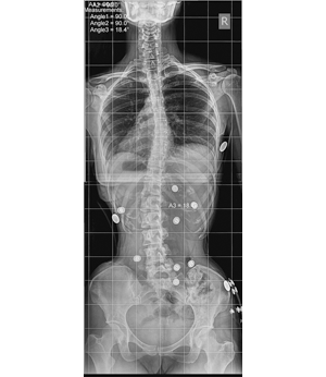 After Image