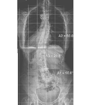 After Image