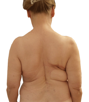 After Image