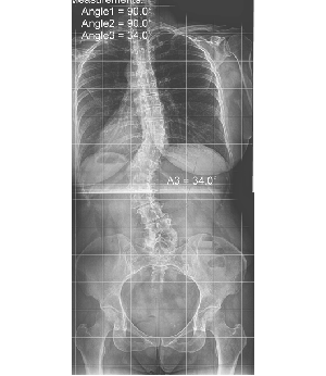 After Image