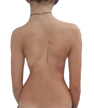 After Image