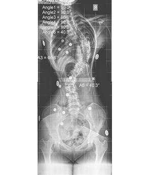 After Image
