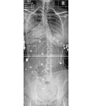 After Image