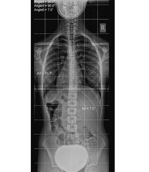 After Image