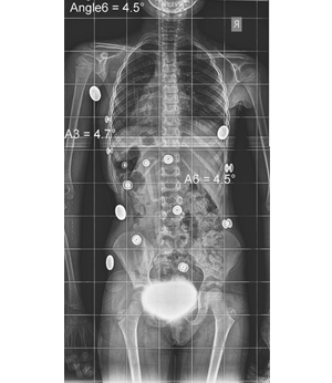 After Image