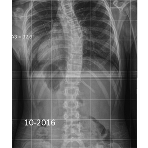 After Image